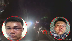 Bấm còi xe xin đường, 2 tài xế container bị nhóm côn đồ đánh bầm dập mặt mũi ở Hà Nam