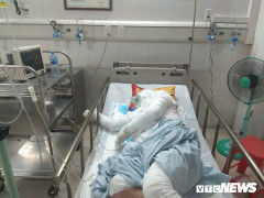 Lời kể nhân chứng vụ xe ô tô gây tai nạn cho lái xe ba gác rồi bỏ chạy ở Hà Nội