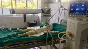 Người đàn ông tẩm xăng đốt 5 người trong một nhà: Thêm một nạn nhân thiệt mạng