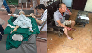 Anh vác dao chém cả gia đình em ruột: Sức khỏe bé gái giờ ra sao?