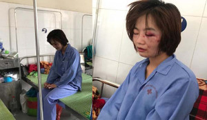 Hai nghi can hành hung nữ phụ xe buýt vẫn chưa ra trình diện