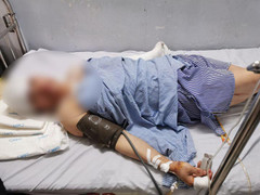 Bà chủ nhà nghỉ vô cớ bị nam thanh niên xông vào chém trọng thương