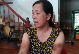 Cán bộ thi hành án bị ‘tố’ hành hung, ép dân ‘điểm chỉ’: Cơ quan điều tra vào cuộc