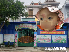 Bé 14 tháng tuổi ở Hải Phòng bị bạn cắn thâm tím mặt: Kiểm điểm làm rõ trách nhiệm 2 giáo viên