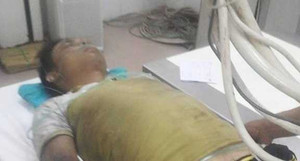 Nổ xe khách 8 người chết: 'Nhiều thi thể nằm la liệt, mắc kẹt trong xe'