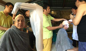 NSƯT Chí Trung bị tai nạn phải khâu 'sống' 6 mũi