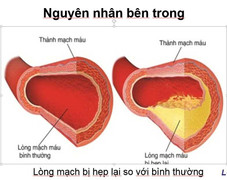 Thiếu máu não, chỉ 7 phút sẽ ngất xỉu