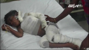 Bị bố đánh rơi vào đống than, bé 6 tuổi nguy kịch