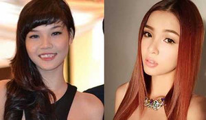 Quá trình phẫu thuật thẩm mỹ lên đời nhan sắc của Kỳ Hân - cô dâu 'hot' nhất hôm nay