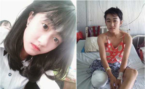 Nữ sinh Đắk Lắk bị cưa chân: Kết luận chính thức vụ việc