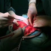 Khối u 'khổng lồ' nặng 6kg trong ổ bụng một phụ nữ ở Đà Nẵng