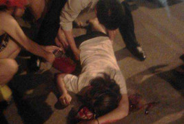 Cô gái trẻ bị giật túi xách ngã xuống đường, đầu be bét máu