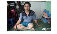 Bị cưa cụt chân, nam thanh niên tố bệnh viện tắc trách