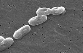 Vi khuẩn 'sát thủ' từ Việt Nam lấy đi mạng người trong 24 giờ thế nào?