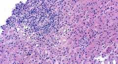 Virus siêu nguy hiểm đe dọa sự sống nhân loại