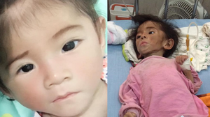 Bé gái hơn 1 tuổi vẫn nhỏ như búp bê, nặng 3,5kg giờ ra sao?