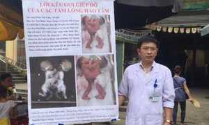 Cảm động tấm lòng Phó giám đốc bệnh viện ra chợ quyên tiền cho 2 bệnh nhi dính bụng