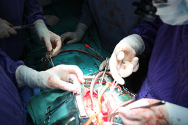 Kỳ diệu khoảnh khắc trái tim đập trong lồng ngực bệnh nhân ngay sau ca ghép tạng