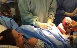 Hình ảnh ngoạn mục khi bé trai tự bò khỏi bụng mẹ giữa ca sinh
