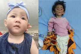 Bé gái 'hơn 1 tuổi vẫn nhỏ như búp bê' giờ đã bụ bẫm, đáng yêu thế này