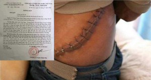 Thực hư thông tin hàng loạt vụ bắt cóc lấy tạng người ở biên giới