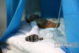 Thiếu niên 13 tuổi hất xăng thiêu sống cô gái trẻ để cướp iPhone rúng động Trung Quốc