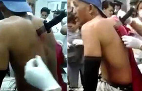 Bị dao đâm ngập lưng, người đàn ông vẫn ngồi 'tỉnh như sáo'