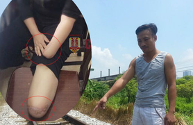 Nhân chứng cứu người phụ nữ tự chặt tay chân tiết lộ những tình tiết bất ngờ