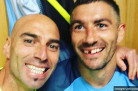 Kolarov gãy răng cửa vẫn hỉ hả cười MU