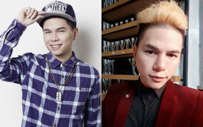 Hoàng Tôn thừa nhận phẫu thuật thẩm mỹ