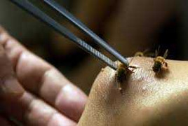 Bị đàn ong tấn công, một bé gái chết thảm