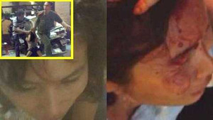 Đình chỉ thiếu úy công an kéo lê người phụ nữ trên đường