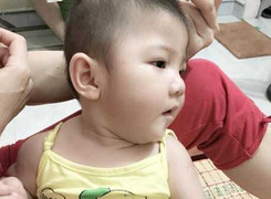 Bất ngờ hình ảnh hiện tại của bé 14 tháng tuổi nặng 3,5kg ở Lào Cai