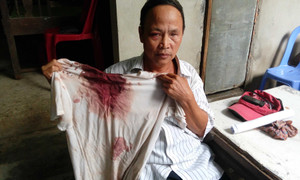 Cha con chi hội trưởng người mù xã bị côn đồ hành hung