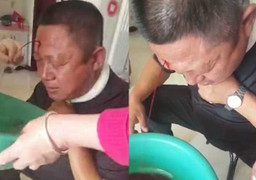 Video: Bệnh nhân chảy máu ồ ạt sau khi bác sỹ châm cứu