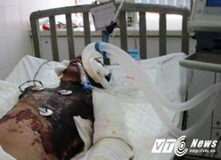 Anh thợ điện 'gà trống nuôi con' bị giật cháy đen, bé gái 4 tuổi ngơ ngác chờ bố về