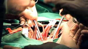 Rùng mình thâm nhập thị trường nội tạng chui