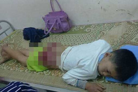 Cha đánh con tứa máu, bầm tím mông: Chuyên gia tâm lý lên tiếng
