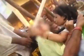 Mải chụp ảnh tự sướng, thiếu nữ bị bánh xe quấn tróc cả mảng da đầu