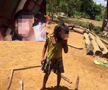 Đắk Lắk: Tiếp tục phát hiện 2 chị em đầu nhỏ nghi nhiễm virut Zika