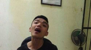 Thanh niên 'ngáo đá' hoang tưởng ồ ạt nhập viện