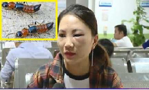 Kiến ba khoang độc tố gấp 15 lần rắn hổ mang ồ ạt tấn công dân Thủ đô có gây chết người?