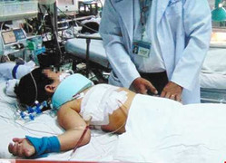 Tai nạn thương tâm bé trai ngã từ tầng 2 bị rào sắt đâm