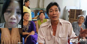 Nữ sinh run sợ kể phút bị bạn châm thuốc lá vào tay, bắt liếm chân