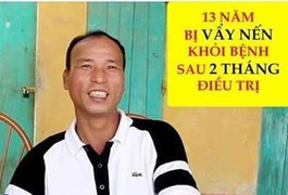 Bệnh nhân tố cáo bị lợi dụng hình ảnh để quảng cáo