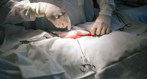 Doanh nhân nghe lời bạn bè uống 10 chai bia/ngày tự chữa sỏi thận suýt mất mạng