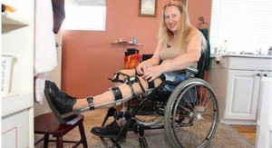 Căn bệnh kỳ lạ nhất thế giới khiến nhân viên y tế ở Cần Thơ tự chặt chân rồi giấu vào tủ lạnh