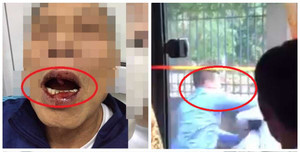 Lái xe đâm cô gái rồi bỏ chạy, cán bộ Sở Ngoại vụ hành hung tiến sĩ 76 tuổi gây phẫn nộ