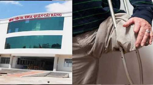 Nhân viên y tế tự chặt chân, dân mạng tranh cãi gay gắt