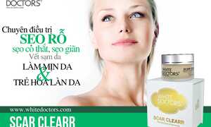 Sẹo rỗ - nỗi ám ảnh không của riêng ai